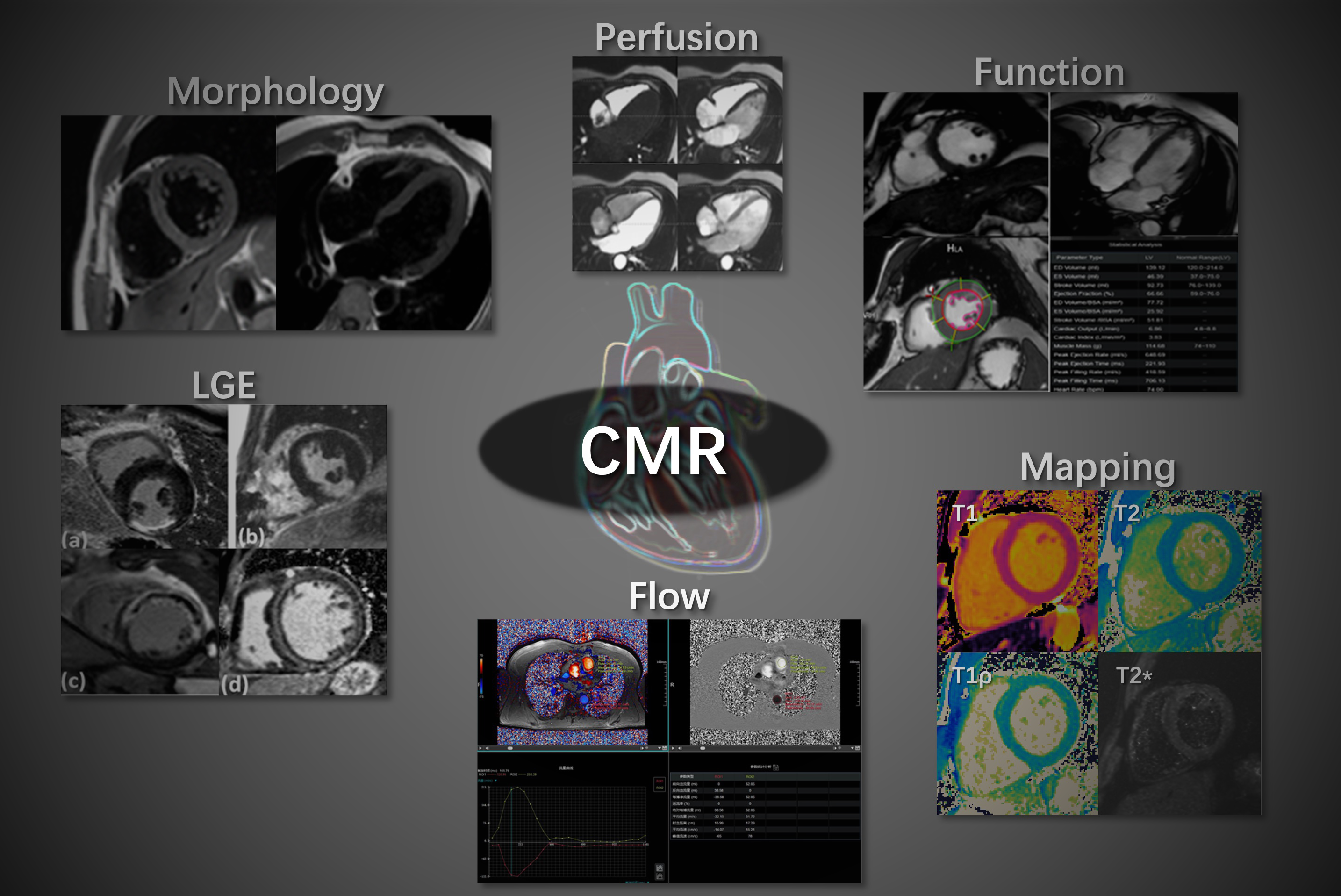 Cardiac MRI Overview